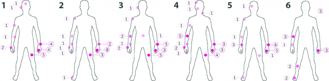 Fig. 2. On-body zones indicated by the study participants for the six interaction modalities; numbers in circles indicate how many times the same zone repeated.